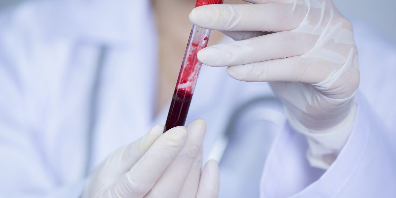 La nécessité d’un test sanguin